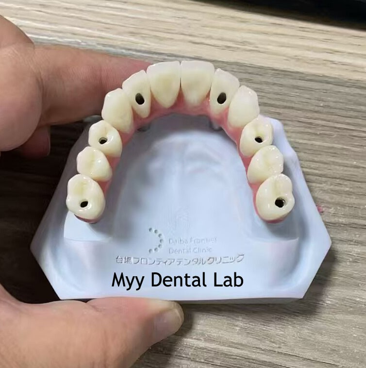 China Customized PFM