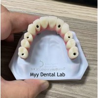 China Customized PFM